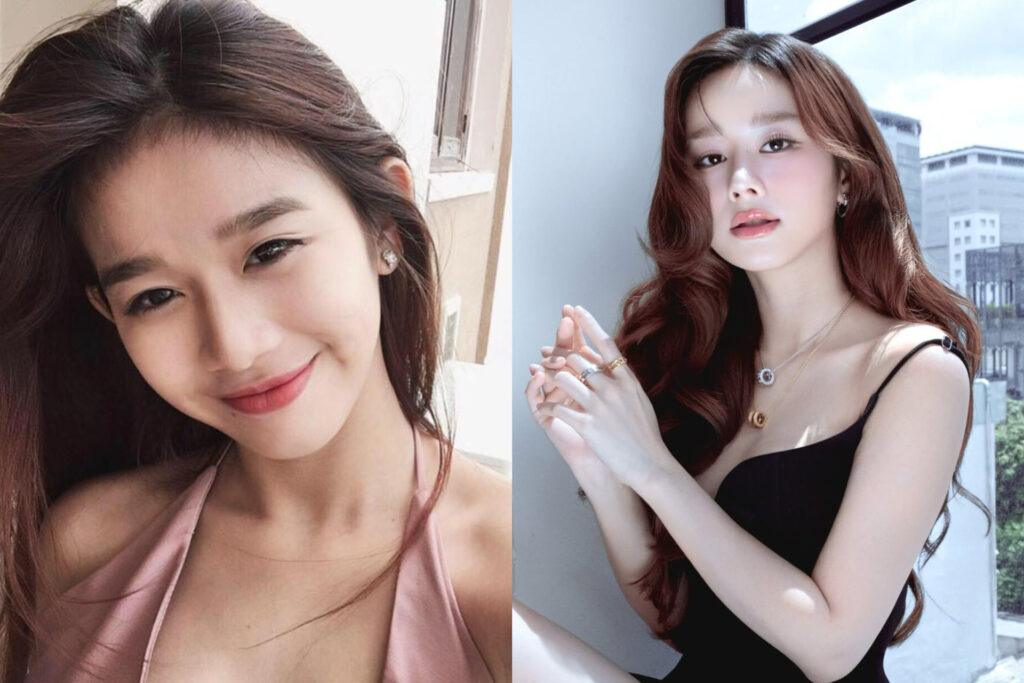 So sánh diện mạo của Thư Đan Nguyễn trước và sau khi làm đẹp