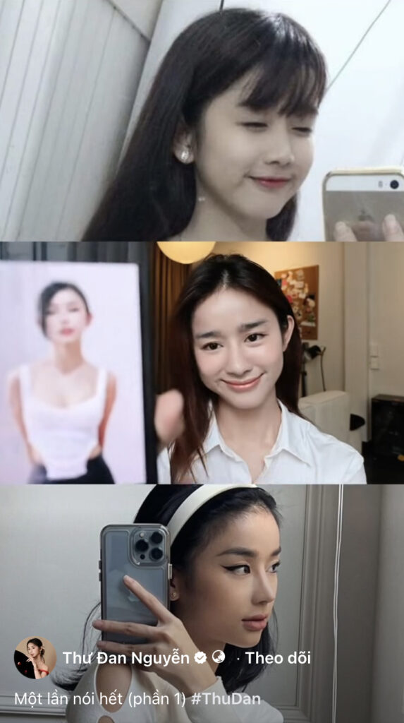 Hình ảnh Thư Đan Nguyễn trước và sau khi điều chỉnh các đường nét