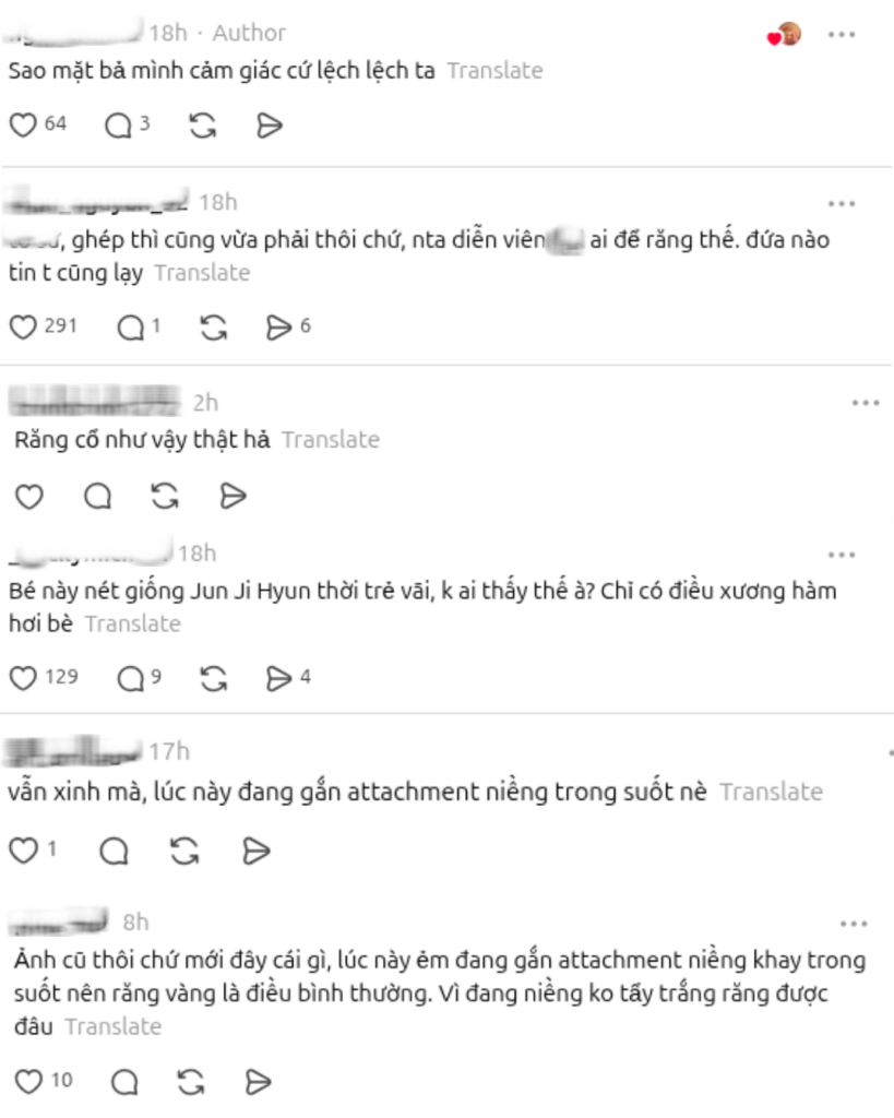 Tôn Thiên khoe diện mạo tươi tắn cùng nụ cười tự nhiên